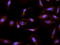 Cytochrome P450 Family 26 Subfamily A Member 1 antibody, TA348981, Origene, Immunofluorescence image 