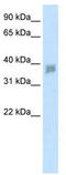 Small Nuclear RNA Activating Complex Polypeptide 3 antibody, TA334780, Origene, Western Blot image 