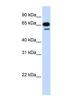 R3H Domain Containing 2 antibody, NBP1-56775, Novus Biologicals, Western Blot image 