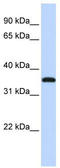 Transcription cofactor vestigial-like protein 3 antibody, TA333779, Origene, Western Blot image 