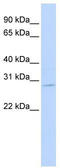 Exosome complex exonuclease RRP42 antibody, TA343822, Origene, Western Blot image 