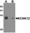 Potassium Two Pore Domain Channel Subfamily K Member 12 antibody, LS-B9547, Lifespan Biosciences, Western Blot image 