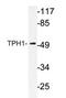 Tryptophan Hydroxylase 1 antibody, AP20275PU-N, Origene, Western Blot image 