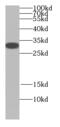 Junctional Sarcoplasmic Reticulum Protein 1 antibody, FNab04450, FineTest, Western Blot image 
