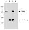 TPX2 Microtubule Nucleation Factor antibody, NBP2-67265, Novus Biologicals, Immunoprecipitation image 