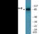 Catenin Beta 1 antibody, EKC2228, Boster Biological Technology, Western Blot image 