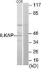 Integrin-linked kinase-associated serine/threonine phosphatase 2C antibody, TA315840, Origene, Western Blot image 