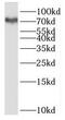 URI1 Prefoldin Like Chaperone antibody, FNab07323, FineTest, Western Blot image 