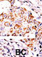 NME/NM23 Nucleoside Diphosphate Kinase 3 antibody, 62-690, ProSci, Immunohistochemistry paraffin image 