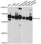 SHOC2 Leucine Rich Repeat Scaffold Protein antibody, A4199, ABclonal Technology, Western Blot image 