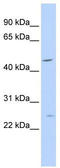 Myelin proteolipid protein antibody, TA334297, Origene, Western Blot image 