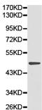 Saccharopine Dehydrogenase (Putative) antibody, TA322339, Origene, Western Blot image 