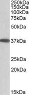 Monoacylglycerol O-Acyltransferase 2 antibody, PA5-19372, Invitrogen Antibodies, Western Blot image 