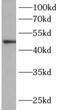 Chitobiosyldiphosphodolichol beta-mannosyltransferase antibody, FNab00305, FineTest, Western Blot image 