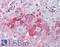 Dual Specificity Phosphatase 26 antibody, LS-A6784, Lifespan Biosciences, Immunohistochemistry frozen image 