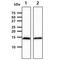 CDGSH Iron Sulfur Domain 1 antibody, GTX57586, GeneTex, Western Blot image 