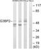 G3BP Stress Granule Assembly Factor 2 antibody, PA5-39397, Invitrogen Antibodies, Western Blot image 