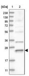 RAB17, Member RAS Oncogene Family antibody, NBP1-85910, Novus Biologicals, Western Blot image 