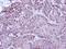 Histone-lysine N-methyltransferase SUV39H1 antibody, GTX112263, GeneTex, Immunohistochemistry paraffin image 