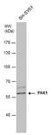 Serine/threonine-protein kinase PAK 1 antibody, PA5-34696, Invitrogen Antibodies, Western Blot image 