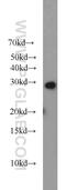 Regulating Synaptic Membrane Exocytosis 4 antibody, 20091-1-AP, Proteintech Group, Western Blot image 