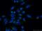 Acyl-CoA Binding Domain Containing 3 antibody, 14096-1-AP, Proteintech Group, Immunofluorescence image 