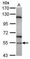 Sperm Associated Antigen 6 antibody, PA5-30318, Invitrogen Antibodies, Western Blot image 