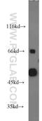 Fatty aldehyde dehydrogenase antibody, 15090-1-AP, Proteintech Group, Western Blot image 