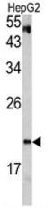 pVHL antibody, AP17826PU-N, Origene, Western Blot image 