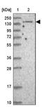 Kinesin Family Member 1C antibody, NBP2-48824, Novus Biologicals, Western Blot image 