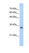 Zinc Finger Protein 227 antibody, NBP1-80194, Novus Biologicals, Western Blot image 