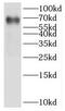 IKAROS Family Zinc Finger 2 antibody, FNab04205, FineTest, Western Blot image 