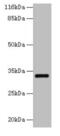 Endoplasmic Reticulum-Golgi Intermediate Compartment 1 antibody, CSB-PA842630LA01HU, Cusabio, Western Blot image 
