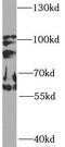 Phosphatidylinositol 3-kinase regulatory subunit alpha antibody, FNab09963, FineTest, Western Blot image 