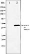 GluN2A antibody, orb99098, Biorbyt, Western Blot image 