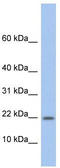 Norrin Cystine Knot Growth Factor NDP antibody, TA335136, Origene, Western Blot image 