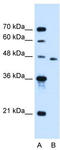 Solute Carrier Family 16 Member 12 antibody, TA334636, Origene, Western Blot image 