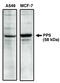 Protein Phosphatase 5 Catalytic Subunit antibody, MBS396080, MyBioSource, Western Blot image 