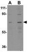 Notum, Palmitoleoyl-Protein Carboxylesterase antibody, GTX85260, GeneTex, Western Blot image 
