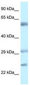 V-Set And Immunoglobulin Domain Containing 10 antibody, TA331086, Origene, Western Blot image 