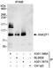 Ankyrin repeat and zinc finger domain-containing protein 1 antibody, A301-387A, Bethyl Labs, Immunoprecipitation image 