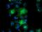 Pyrroline-5-Carboxylate Reductase 3 antibody, GTX83750, GeneTex, Immunofluorescence image 