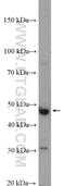 Cytochrome P450 Family 17 Subfamily A Member 1 antibody, 14447-1-AP, Proteintech Group, Western Blot image 