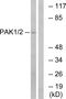 Serine/threonine-protein kinase PAK 1 antibody, PA5-38693, Invitrogen Antibodies, Western Blot image 