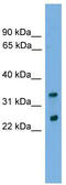 Charged Multivesicular Body Protein 4B antibody, TA337562, Origene, Western Blot image 