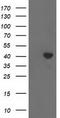 Sterol O-acyltransferase 2 antibody, TA501221, Origene, Western Blot image 