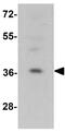 Ras Association Domain Family Member 6 antibody, GTX17157, GeneTex, Western Blot image 