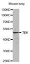 TEK Receptor Tyrosine Kinase antibody, abx000844, Abbexa, Western Blot image 