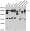 Tyrosine Aminotransferase antibody, GTX64477, GeneTex, Western Blot image 