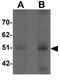 F-Box And Leucine Rich Repeat Protein 16 antibody, GTX31424, GeneTex, Western Blot image 